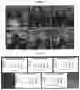 Fig. 34 - Methods and systems to determine cancer molecular subtypes based on ultrasound and/or optoacoustic (OA/US) features