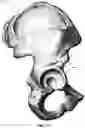 Fig. 17 - Quantitative assessment of prosthesis press-fit fixation