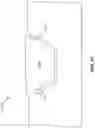 Fig. 24 - Quantitative assessment of prosthesis press-fit fixation