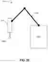 Fig. 26 - Quantitative assessment of prosthesis press-fit fixation