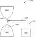Fig. 01 - Quantitative assessment of implant installation