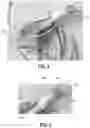 Fig. 03 - Systems for a water collection assembly for an imaging cable