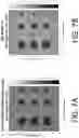 Fig. 15 - ULTRASOUND IMAGING USING COMPLEMENTARY CODES