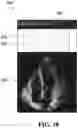Fig. 11 - Ultrasonic image analysis