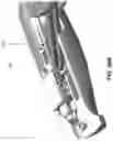 Fig. 50 - Medical instruments for performing minimally-invasive procedures