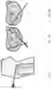 Fig. 14 - Repair device and method for deploying anchors