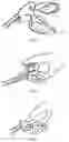 Fig. 04 - Knot-tying device for surgical sutures