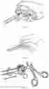 Fig. 06 - Knot-tying device for surgical sutures