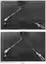 Fig. 14 - Knot-tying device for surgical sutures