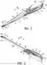 Fig. 02 - Apparatus and method for securing tissue