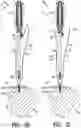 Fig. 07 - Apparatus and method for securing tissue