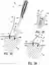 Fig. 09 - Apparatus and method for securing tissue