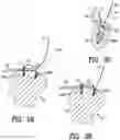 Fig. 10 - Apparatus and method for securing tissue