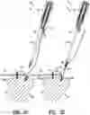 Fig. 11 - Apparatus and method for securing tissue