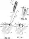 Fig. 12 - Apparatus and method for securing tissue