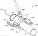 Fig. 01 - Aortic occlusion device