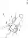 Fig. 02 - Aortic occlusion device