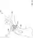 Fig. 13 - Aortic occlusion device