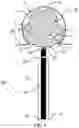 Fig. 02 - Aneurysm device and delivery system