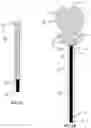 Fig. 03 - Aneurysm device and delivery system