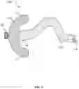 Fig. 05 - Aneurysm device and delivery system
