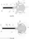 Fig. 06 - Aneurysm device and delivery system