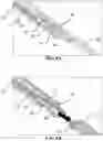 Fig. 09 - Aneurysm device and delivery system