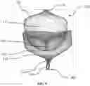 Fig. 10 - Aneurysm device and delivery system