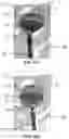 Fig. 12 - Aneurysm device and delivery system