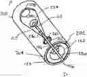 Fig. 01 - SPRING FOR MOVEABLE JAWS OF DEVICE AND DELIVERY SYSTEM FOR RELEASING THERAPAUTIC APPLIANCE