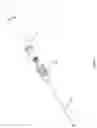 Fig. 02 - Coupling mechanism for a surgical device