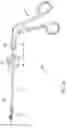 Fig. 05 - A SURGICAL DEVICE, A METHOD FOR ASSEMBLING AND A METHOD FOR De-ASSEMBLING