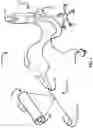 Fig. 02 - Ultrasonically flared medical-device components and methods thereof