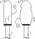 Fig. 04 - Ultrasonically flared medical-device components and methods thereof
