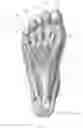 Fig. 02 - Systems, devices, and non-invasive surgical methods for treating plantar fasciitis and chronic heel spur syndrome