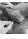 Fig. 05 - Systems, devices, and non-invasive surgical methods for treating plantar fasciitis and chronic heel spur syndrome