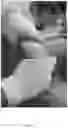 Fig. 15 - Systems, devices, and non-invasive surgical methods for treating plantar fasciitis and chronic heel spur syndrome