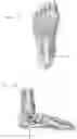 Fig. 19 - Systems, devices, and non-invasive surgical methods for treating plantar fasciitis and chronic heel spur syndrome