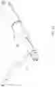 Fig. 19 - High speed chronic total occlusion crossing devices