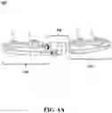 Fig. 02 - External orthopedic fixation device