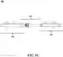 Fig. 04 - External orthopedic fixation device