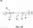Fig. 11 - External orthopedic fixation device