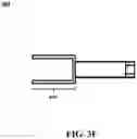 Fig. 13 - External orthopedic fixation device