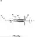 Fig. 14 - External orthopedic fixation device