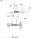 Fig. 15 - External orthopedic fixation device