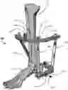 Fig. 01 - External fixation for the correction of bone deformity and trauma