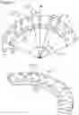 Fig. 02 - External fixation for the correction of bone deformity and trauma