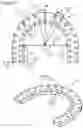 Fig. 03 - External fixation for the correction of bone deformity and trauma