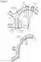 Fig. 05 - External fixation for the correction of bone deformity and trauma