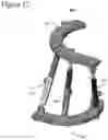 Fig. 13 - External fixation for the correction of bone deformity and trauma